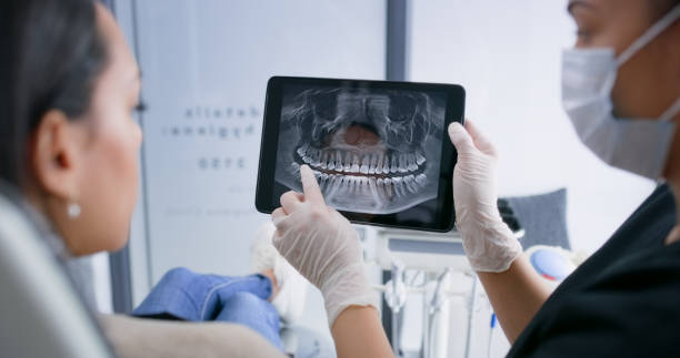 Licensed Dental Implants service in Ives Estates, FL - Smile Center Dentistry